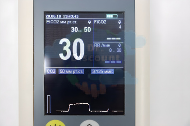 Монитор СО2 портативный реанимационный «КапноТест» (капнографический датчик, производства Китай)